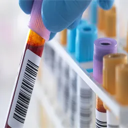 discount on lab tests